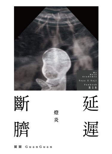延遲斷臍 封面圖